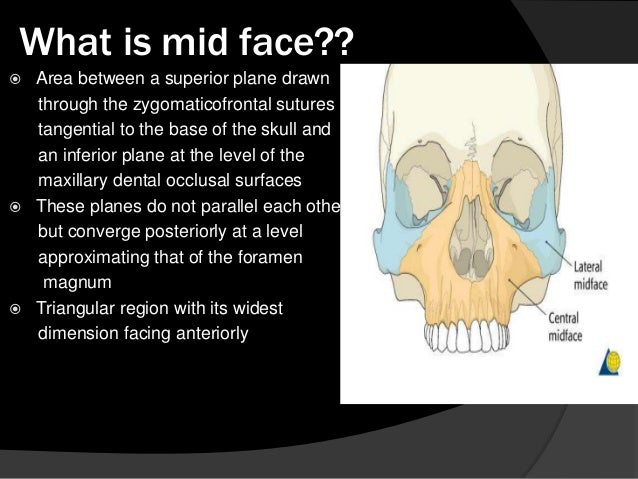 facial fracture slideshows My boobs are bigger than moms